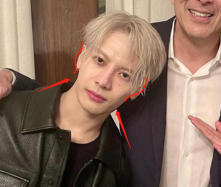 深度解析明星整容后遺癥，觀點(diǎn)與影響探討